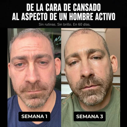 Serum Anti-edad para Hombres